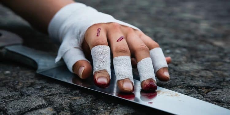 Paris : Un Homme Perd Plusieurs Doigts En Essayant De Récupérer Son Katana Volé - Viral Mag Rue du vol dun katana a tourné au drame à Paris mutilant partiellement son propriétaire qui tentait de le récupérer auprès de ses agresseurs Viral Mag