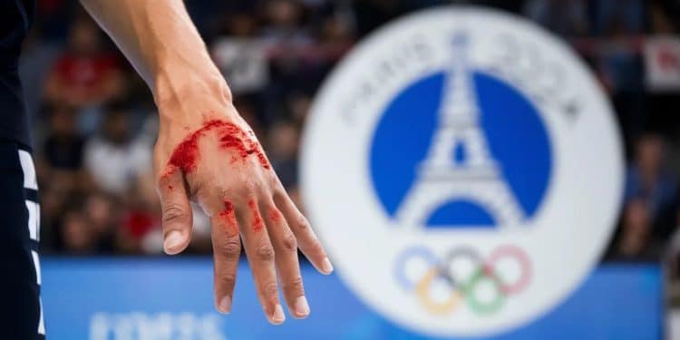 Dika Mem blessé à la main : Quel impact pour les Bleus aux JO ? - Viral Mag Blessure de Dika Mem avant les JO de Paris 2024  Les Bleus du handball dans lincertitude alors que Kentin Mahé est appelé en renfort   Viral Mag