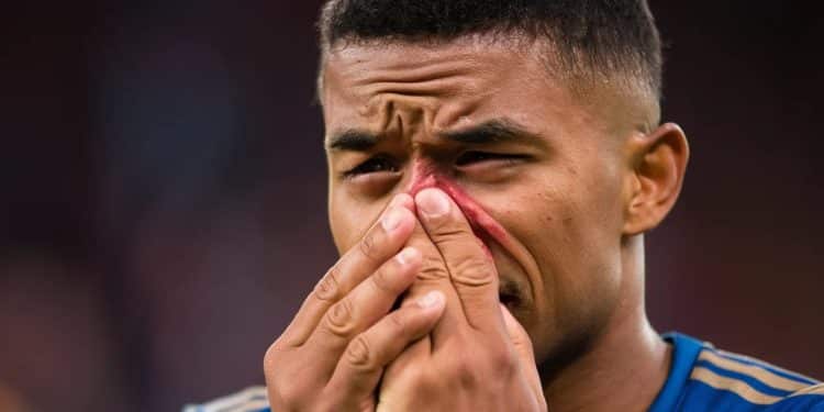 Gros Frisson chez les Bleus : Mbappé Touché au Nez ! - Viral Mag Le choc Portugal France a connu une frayeur lorsque Kylian Mbappé sest plaint dune douleur au nez Retour sur ce moment intense Viral Mag