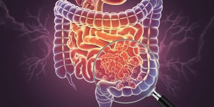 Les Dangers de l’Alcool Pour Votre Microbiome Intestinal - Viral Mag Découvrez les effets néfastes de lalcool sur votre microbiome intestinal même lors dune consommation occasionnelle selon un gastro entérologue réputé Viral Mag