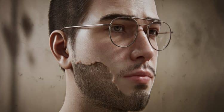 Mathieu jeune français de 24 ans sest donné la mort après une greffe de barbe manquée en Turquie Son père témoigne pour alerter sur les dangers   Viral Mag