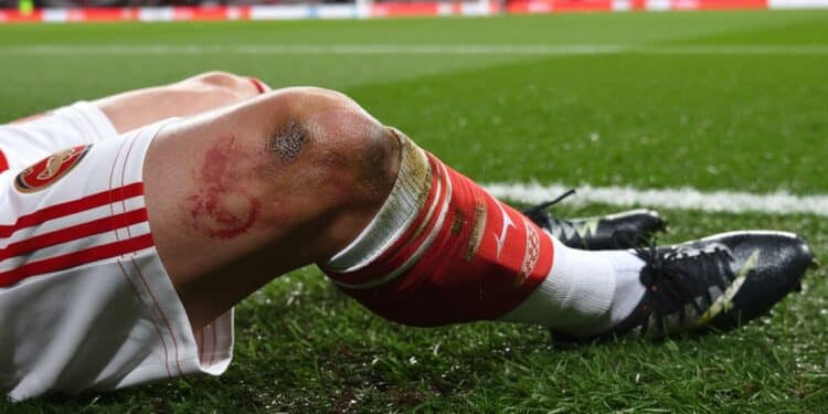 Gabriel Jesus D’Arsenal Blessé Au Genou: Longue Absence Redoutée - Viral Mag Arsenal craint une longue indisponibilité pour son attaquant brésilien Gabriel Jesus sorti sur blessure dimanche Une rupture des ligaments est suspectée   Viral Mag