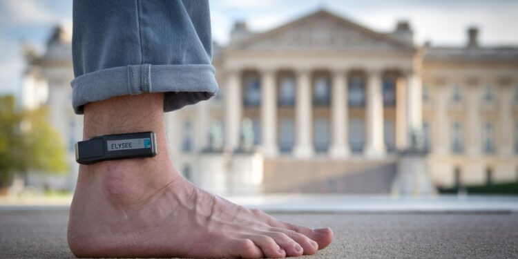 Nicolas Sarkozy Mis Sous Bracelet Électronique : Un Ex-Président Contraint Au Silence - Viral Mag Condamné dans laffaire des écoutes Nicolas Sarkozy a annoncé mettre entre parenthèses ses activités publiques et médiatiques Viral Mag