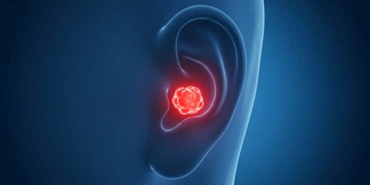 Laurence Boccolini : Une Tumeur Rare Révélée - Viral Mag Laurence Boccolini dévoile sa lutte contre une tumeur rare dans son livre Radiothérapie comme seul espoir plongez dans son combat intime Viral Mag